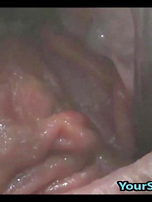 Extreme Anal And Pussy Prolapse After Bizarre Dp