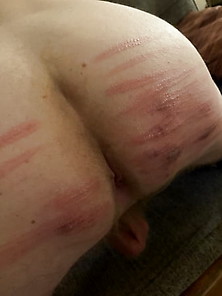 After Last Nights Caning