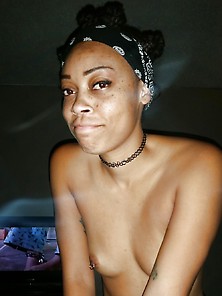 Freckled Black Girl Posing For Her Boyfriend.