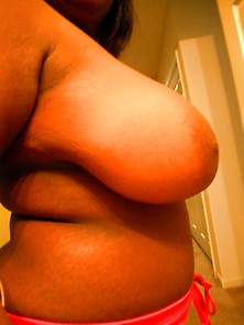 Pre-Breast Reduction Tits 1